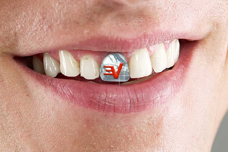 encryption crystal tooth jewels